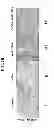 Fig. 07 - Detection Marker for Anticancer Effects by Selenomethionine as an Inhibitor of Environmental Toxicity