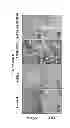 Fig. 13 - Detection Marker for Anticancer Effects by Selenomethionine as an Inhibitor of Environmental Toxicity