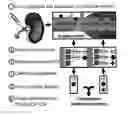 Fig. 01 - Vascular Tumor Markers