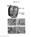 Fig. 03 - Vascular Tumor Markers