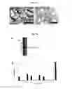 Fig. 13 - Vascular Tumor Markers