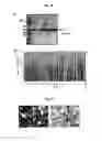 Fig. 14 - Vascular Tumor Markers