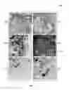 Fig. 09 - Metal nanoparticle decorated carbon nanotubes and methods of preparation and use