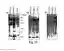 Fig. 25 - Method of co-expressing galactosyltransferase and a glycoprotein in a transgenic plant cell and sialylating the glycoprotein for production of glycoprotein having human-type sugar chain