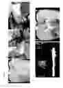 Fig. 02 - Bioengineered allogeneic blood vessel