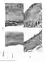 Fig. 09 - Bioengineered allogeneic blood vessel