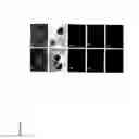 Fig. 07 - Derivation of embryonic stem cells