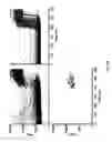 Fig. 08 - Method for determining the propensity for calcification
