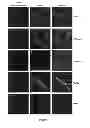 Fig. 08 - PERIPHERIN-SPECIFIC AUTOANTIBODIES AS A MARKER FOR NEUROLOGICAL AND ENDOCRINOLOGICAL DISEASE