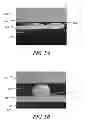 Fig. 08 - Microelectronic flip chip packages with solder wetting pads and associated methods of manufacturing