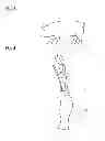 Fig. 04 - Deboning system and deboning method for arm part of bone-in meat