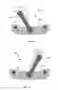 Fig. 19 - Golf club configured for multiple adjustability