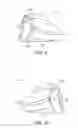 Fig. 06 - Golf club head with flexure