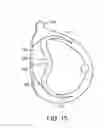 Fig. 09 - Golf club head with flexure