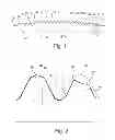 Fig. 02 - Planet for a planetary rolling-contact screw