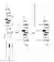 Fig. 11 - Amplification and analysis of selected targets on solid supports