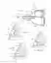 Fig. 14 - Irrigation and aspiration device and method