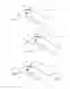 Fig. 16 - Irrigation and aspiration device and method