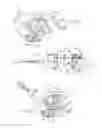 Fig. 19 - Irrigation and aspiration device and method