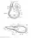 Fig. 23 - Irrigation and aspiration device and method