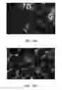 Fig. 07 - Methods for treating vascular leak syndrome