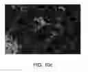 Fig. 08 - Methods for treating vascular leak syndrome