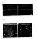 Fig. 09 - COMPOSITIONS AND METHODS FOR TREATING NEURODEGENERATIVE DISEASE