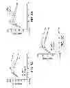Fig. 06 - Methods of preventing and treating diabetes by inhibiting serotonin synthesis
