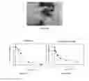Fig. 13 - Small molecule xanthine oxidase inhibitors and methods of use