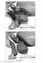 Fig. 07 - METHODS, SYSTEMS AND COMPUTER READABLE STORAGE MEDIA STORING INSTRUCTIONS FOR GENERATING A RADIATION THERAPY TREATMENT PLAN