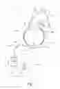 Fig. 04 - Ventricular assist device