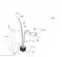 Fig. 01 - Artificial urinary sphincter system having a cuff with an inflatable balloon attached to a frame