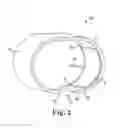 Fig. 03 - Artificial urinary sphincter system having a cuff with an inflatable balloon attached to a frame