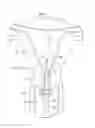 Fig. 01 - UTERINE LAVAGE FOR EMBRYO RETRIEVAL