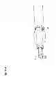Fig. 06 - UTERINE LAVAGE FOR EMBRYO RETRIEVAL