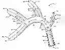 Fig. 01 - Multi-Furcated Tine Erotic Stimulation Device