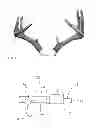 Fig. 02 - Multi-Furcated Tine Erotic Stimulation Device
