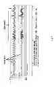 Fig. 09 - Pulsation detector