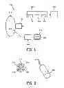Fig. 02 - SYSTEM AND METHOD FOR NEEDLE NAVITATION USING PA EFFECT IN US IMAGING