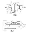 Fig. 04 - Anchoring apparatus and method for attaching device on body