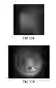 Fig. 48 - APPARATUS, DEVICES AND METHODS FOR OBTAINING OMNIDIRECTIONAL VIEWING BY A CATHETER