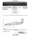 Fig. 52 - APPARATUS, DEVICES AND METHODS FOR OBTAINING OMNIDIRECTIONAL VIEWING BY A CATHETER