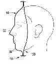 Fig. 01 - Device and method for capturing a surface of an object