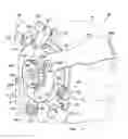 Fig. 01 - Focused ultrasonic transducer navigation system