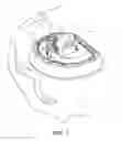 Fig. 08 - Ear molding device for correcting misshaped ears