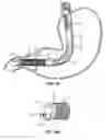 Fig. 02 - Apparatus and methods for anchoring in the stomach and the duodenum