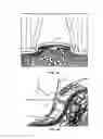 Fig. 05 - Method and system for delivering solution into the pores of recipient human skin