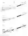Fig. 02 - Injection devices