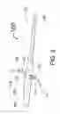 Fig. 03 - PERI-VASCULAR TISSUE ABLATION CATHETER WITH MECHANICAL SUPPORT STRUCTURES