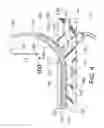 Fig. 05 - PERI-VASCULAR TISSUE ABLATION CATHETER WITH MECHANICAL SUPPORT STRUCTURES